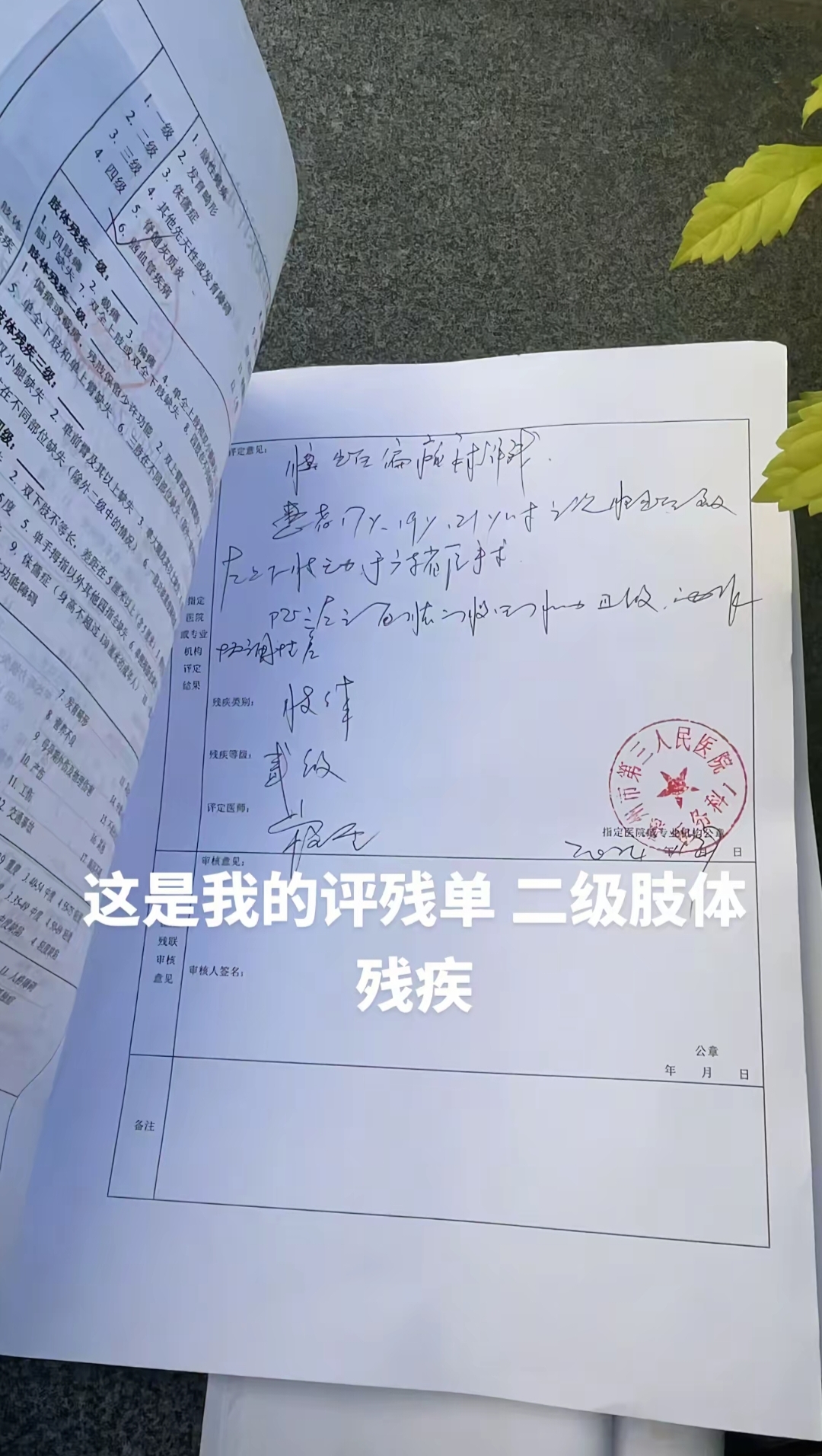 博主, 残疾, 我比断个手